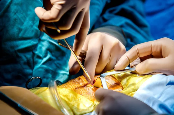 外科医生的助手用特殊的医疗器械传播伤口 以提供外科医生进入心脏的途径 — 图库照片