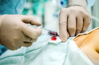 Hastanın ameliyat öncesi için bir merkezi Venöz kateter ayarlama.