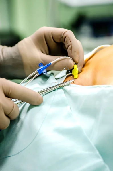 Process Sewing Central Catheter — Stock Photo, Image