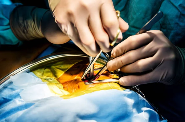 Chirurg Poskytuje Přístup Srdci Během Srdeční Chirurgii — Stock fotografie