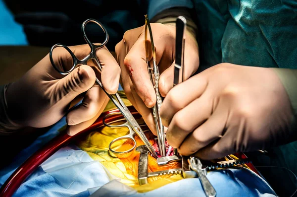 Instrumentos Médicos Manos Del Cirujano Asistente Durante Operación —  Fotos de Stock