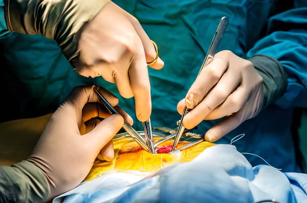 Хірург Забезпечує Собі Доступ Серця Пацієнта Усунення Недоліків — стокове фото