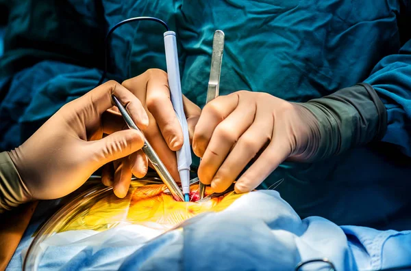 Realizar Corte Por Cirujano Utilizando Cuchillo Médico Eléctrico Durante Una —  Fotos de Stock