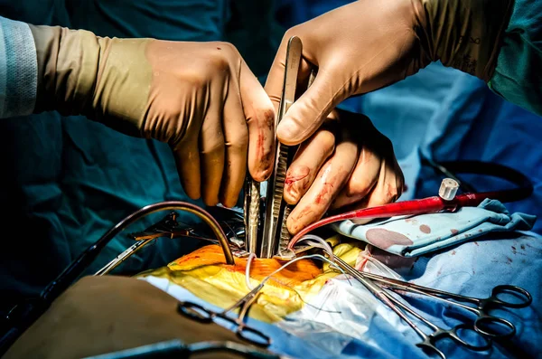 Proceso Realización Una Cirugía Del Corazón Utilizando Aparato Circulación Arterial — Foto de Stock