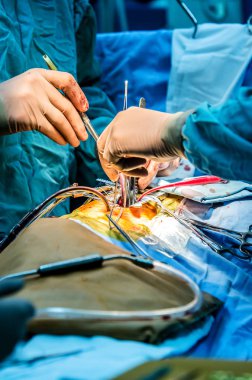 Kalp cerrahisi süreci.