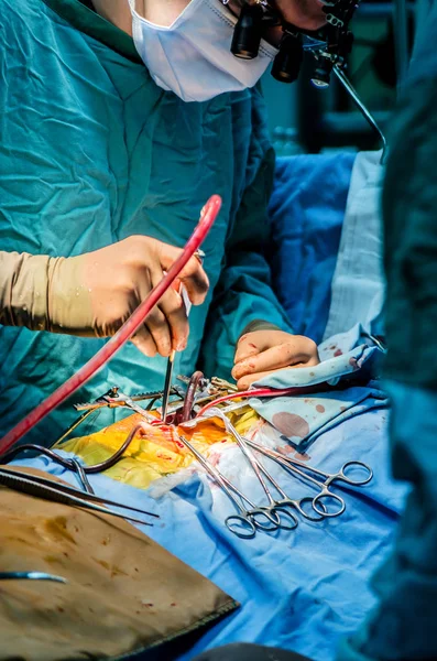 Kirurgen Operationen Tar Bort Blod Från Såret Med Medicinsk Sug — Stockfoto