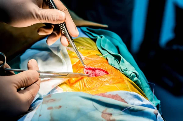 Ράμματα Μετά Από Καρδιοχειρουργική Επέμβαση — Φωτογραφία Αρχείου