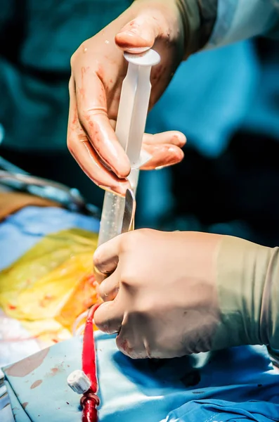 外科医生在手术中向心室里注入生理盐水来检查瓣膜的能力 — 图库照片