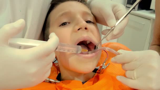 Dentist gently works on the child theet — Stock video