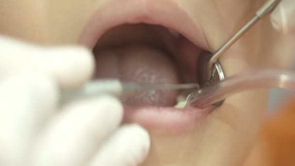 Стоматолог працює над зубами дитини — стокове відео