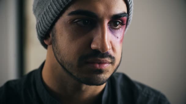 Pensive and sad wounded young man,close up — Stock Video