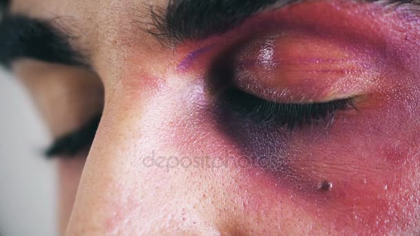 Detail des Auges eines jungen Mannes verletzt und geprellt — Stockvideo
