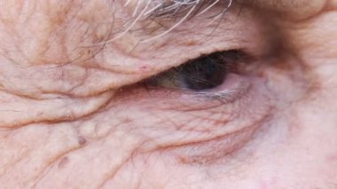 buruşuk adamın gözünü
