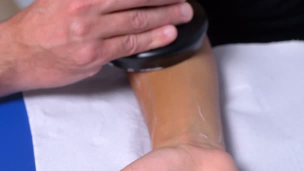 Close Fysiotherapeut Behandeling Patiënten Arm Met Een Laserstraal — Stockvideo