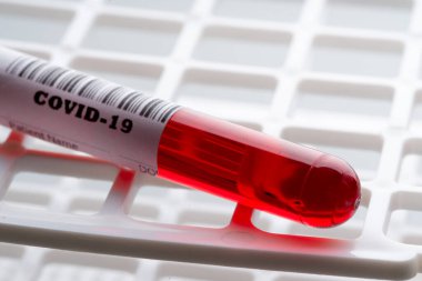 COVID 19 virüsü için kan testi örneği 