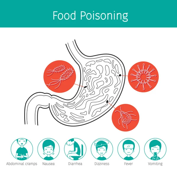 Mide ağrısı ve gıda zehirlenmesi için mide neden mikropları — Stok Vektör