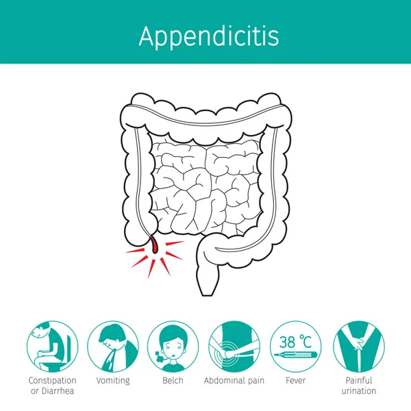 Ilustración del intestino humano, esquema y síntoma de apendicitis — Archivo Imágenes Vectoriales
