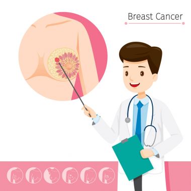 Doctor Describes About Cause To Breast Cancer clipart