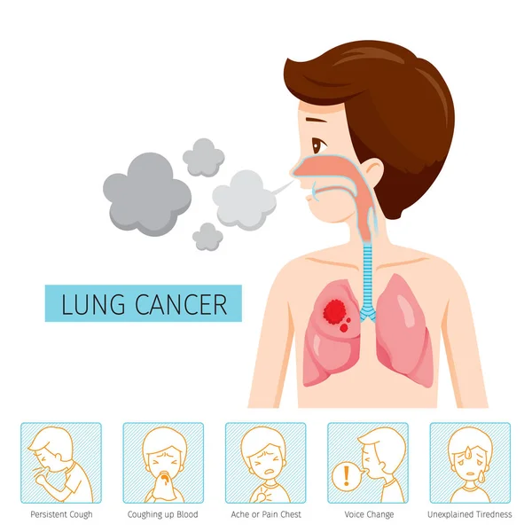Mannen med Lung Cancer Diagram och symtom ikoner — Stock vektor