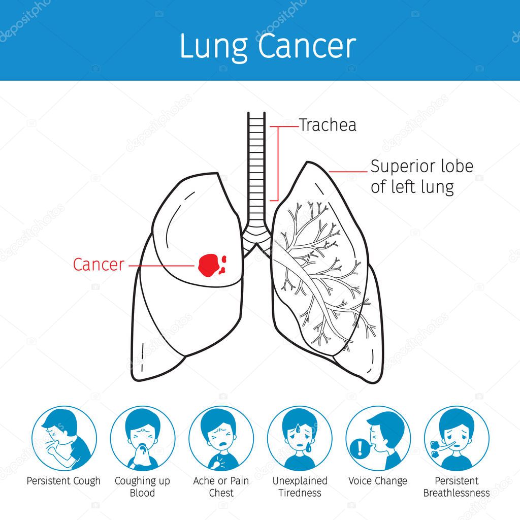 Illustration Of Human Lungs, Outline And Lung Cancer Symptoms Ic