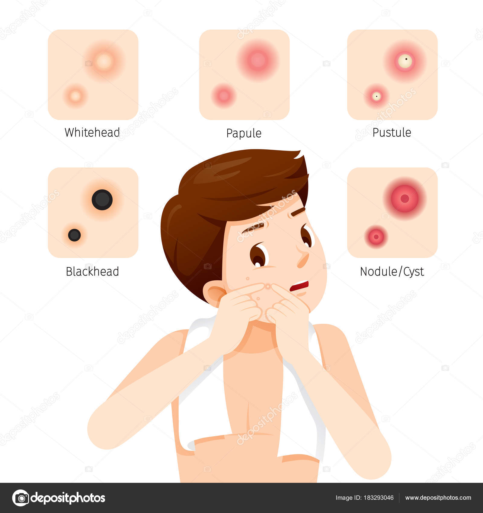 Acne Types And Man With Acne On Face Stock Vector C Matoommi