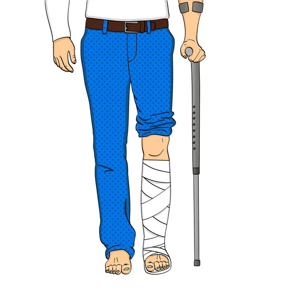 Popart Männerbeine aus Gips, Stock und Stützen. Rehabilitation bedeutet. Vektorobjekt auf weißem Hintergrund — Stockvektor