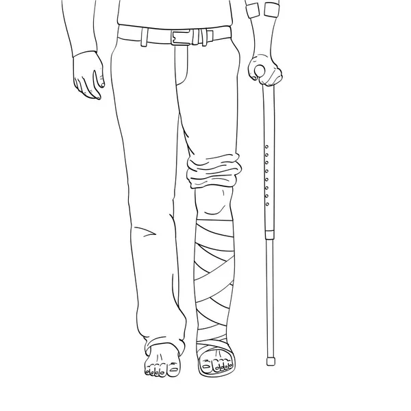 Popart mannen benen in gips, riet en ondersteuning. Revalidatie middelen. Vector-Object op een witte achtergrond. Kleurboek — Stockvector