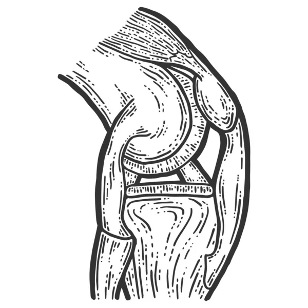 Anatomía. Estructura articulación rodilla vector boceto rayado tablero imitación . — Vector de stock