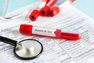 Hepatit B testi için kan örneği içeren kırmızı kan şişesi..