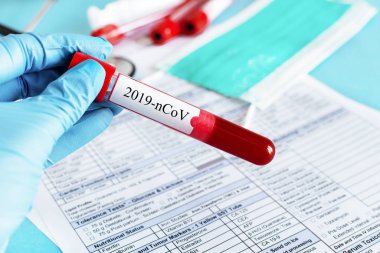 Doktorun elinde Coronavirus testi için kan örneği olan kırmızı kan şişesi var..