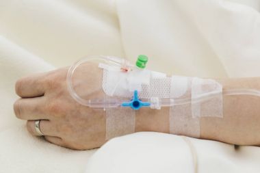 İntravenöz damla portre