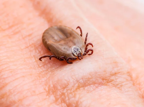 Enzephalitis oder Lyme-Borreliose infizierte Zeckeninsekt auf Haut Makro Nahaufnahme — Stockfoto