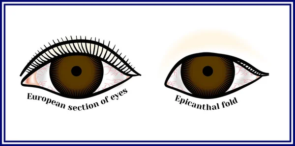 Pliegue epicantal (pliegue palpebronasal). Pliegue epicantal. Doble en la esquina interna del ojo . — Vector de stock