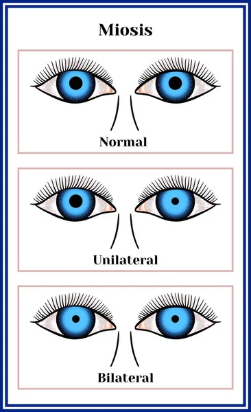 Миоз — стоковый вектор