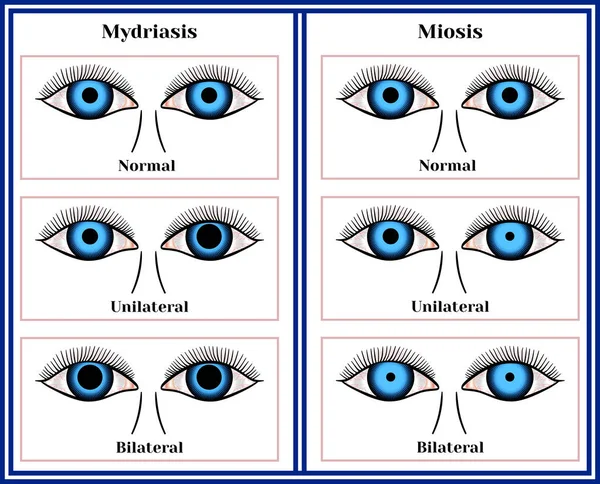 Miriasis y miosis . Gráficos Vectoriales