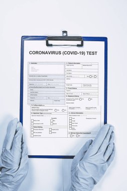 Koronavirüs test formunu dolduran tanınmayan doktor ya da hemşire elleri. COVID-19 testini yapın. 2019-Ncov testi. Yeni koronavirüs için tıbbi test formu