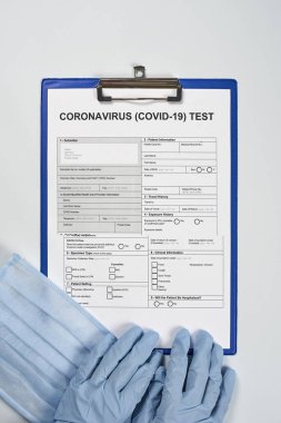 Koronavirüs test formunu dolduran tanınmayan doktor ya da hemşire elleri. COVID-19 testini yapın. 2019-Ncov testi. Yeni koronavirüs için tıbbi test formu