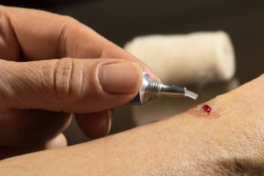 İlk yardım, antibiyotik krem dezenfekte