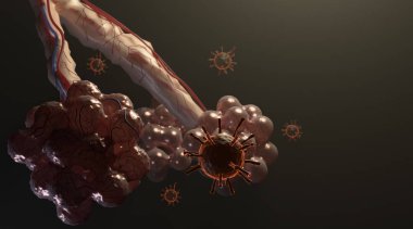 Akciğer alveolü ve korona virüsü enfeksiyonu