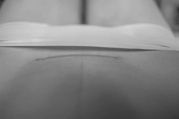 Fechar a barriga da mulher com uma cicatriz de uma cesariana — Fotografia de Stock