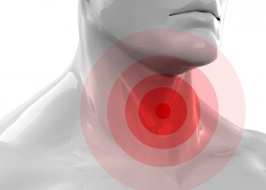 Sore Throat Concept - 3D clipart