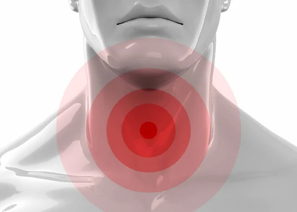 Pijnlijke keel concept - 3D — Stockfoto