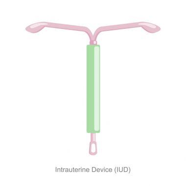 Intrauterine aygıt spiral