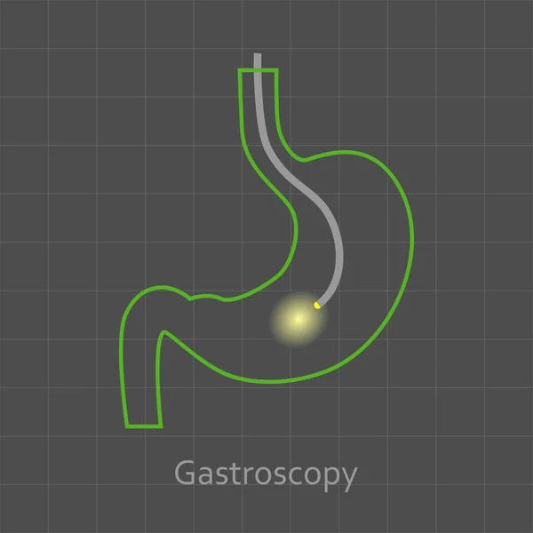 Gastroscopia Procedimiento Icono — Vector de stock