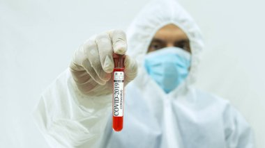 Maskeli bir doktor ve kollarını ileri uzatmış beyaz bioprotatif giysili bir doktor ve sağ elinde kan örneği ve beyaz arka planda Covid-19 etiketi bulunan bir test tüpü tutuyor.