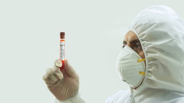Maskeli ve bioprotatif kıyafetli bir doktorun elinde Covid-19 etiketli bir kan örneği tüpü tutarken ve beyaz arka planda dikkatlice ona bakarken yan görüntüsü.
