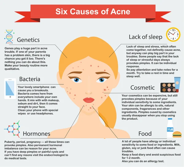 Causas de acne. Problemas de pele e doenças infográficos de beleza — Vetor de Stock