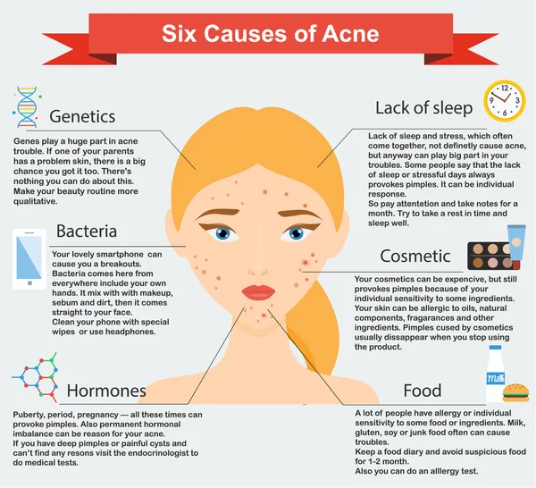 Causas del acné. Problemas de la piel e infografías de belleza — Vector de stock