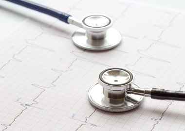 kardiyogram beyaz bir zemin üzerine iki stetoskop