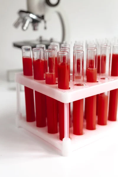 Blood in glass tubes on background of microscope Stock Image